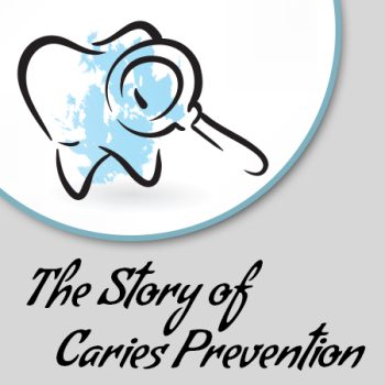 Indianapolis dentist, Dr. Sammons of the Center for Advanced Dentistry, explains the link between tooth decay, dental caries, and cavities.