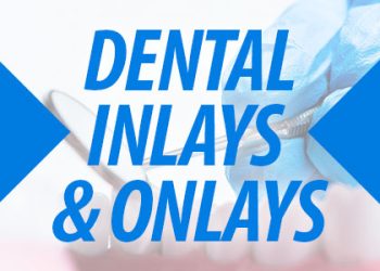 Indianapolis dentist, Dr. Brad Sammons at Center for Advanced Dentistry shares all you need to know about inlays and onlays to repair damaged teeth in form and function.